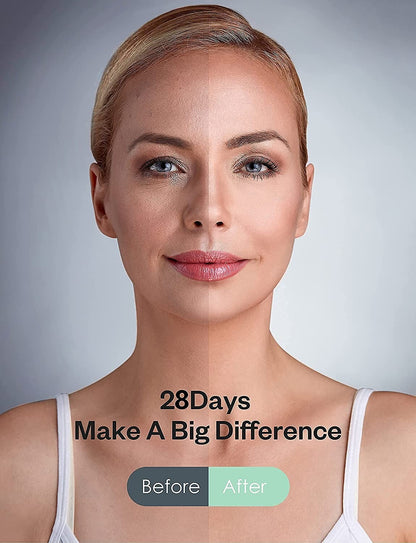 Skin Tightening Machine Face Lifting for Wrinkles Removing Body Skin Spa